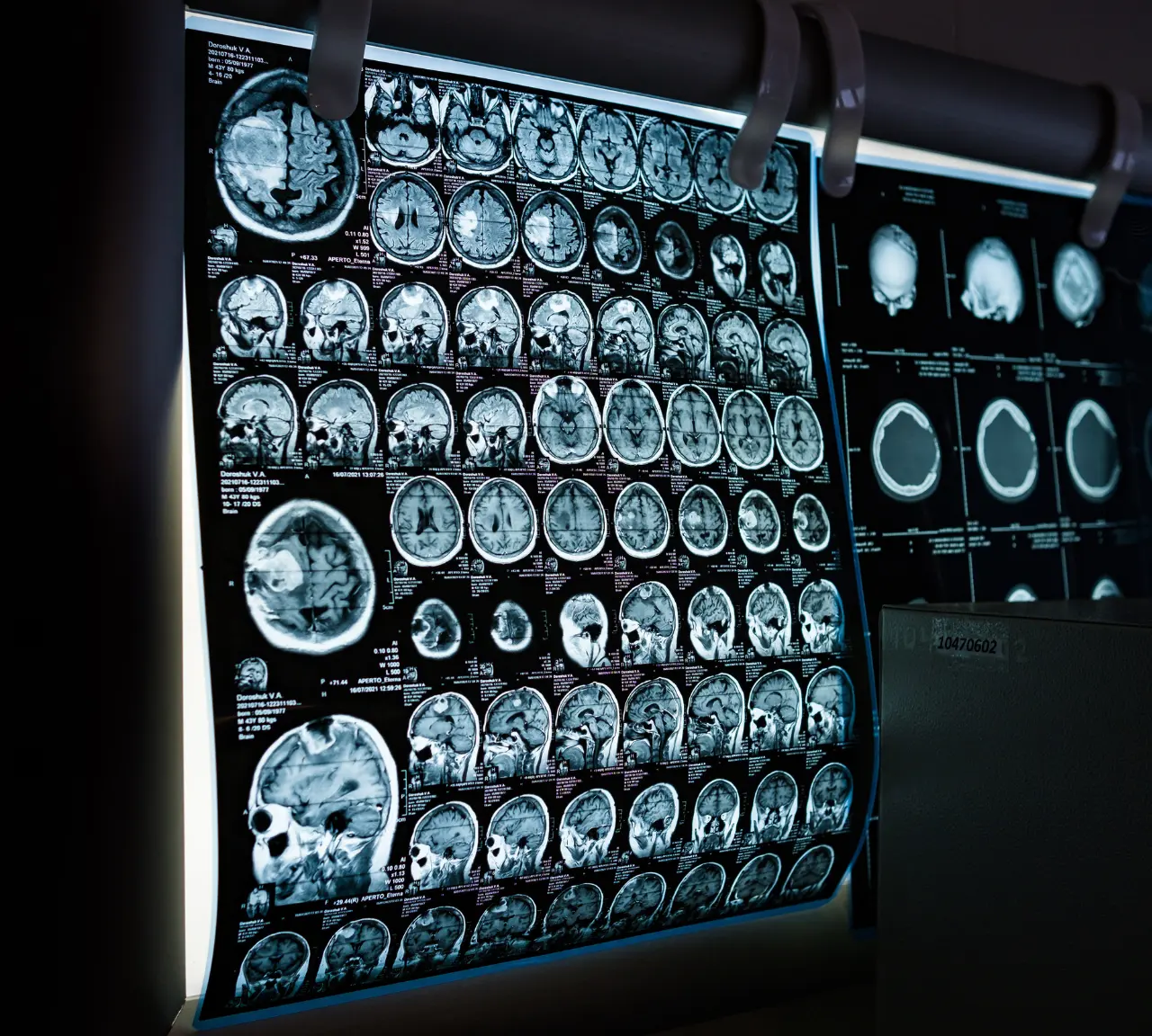 Neurological Conditions