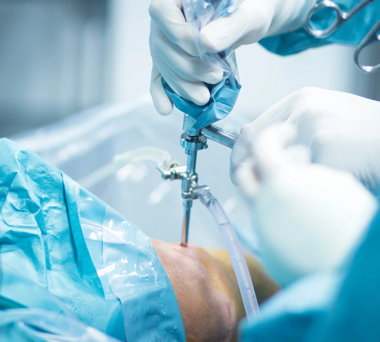Minimally Invasive Treatments