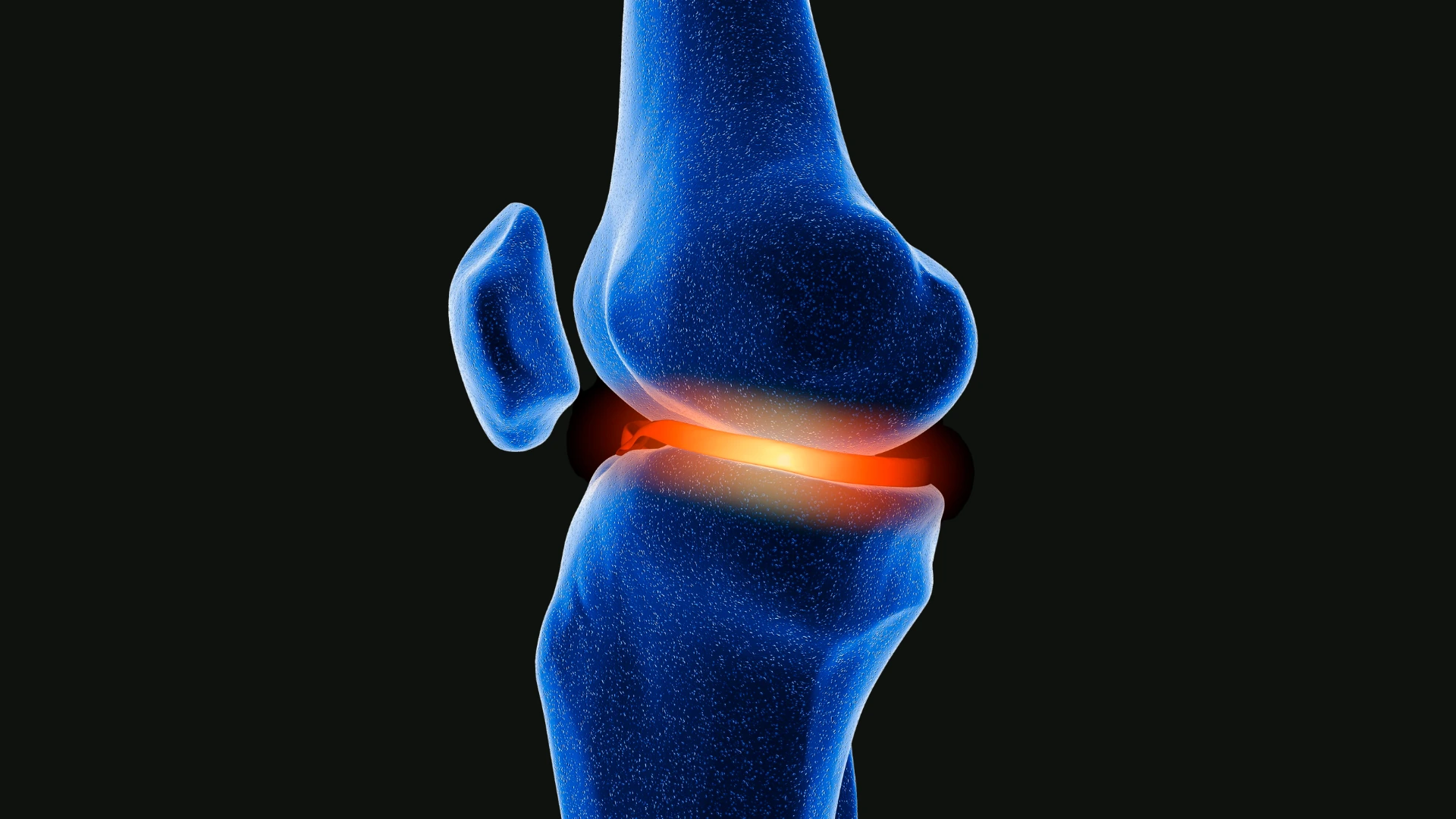 Bone & Joint Center Overview