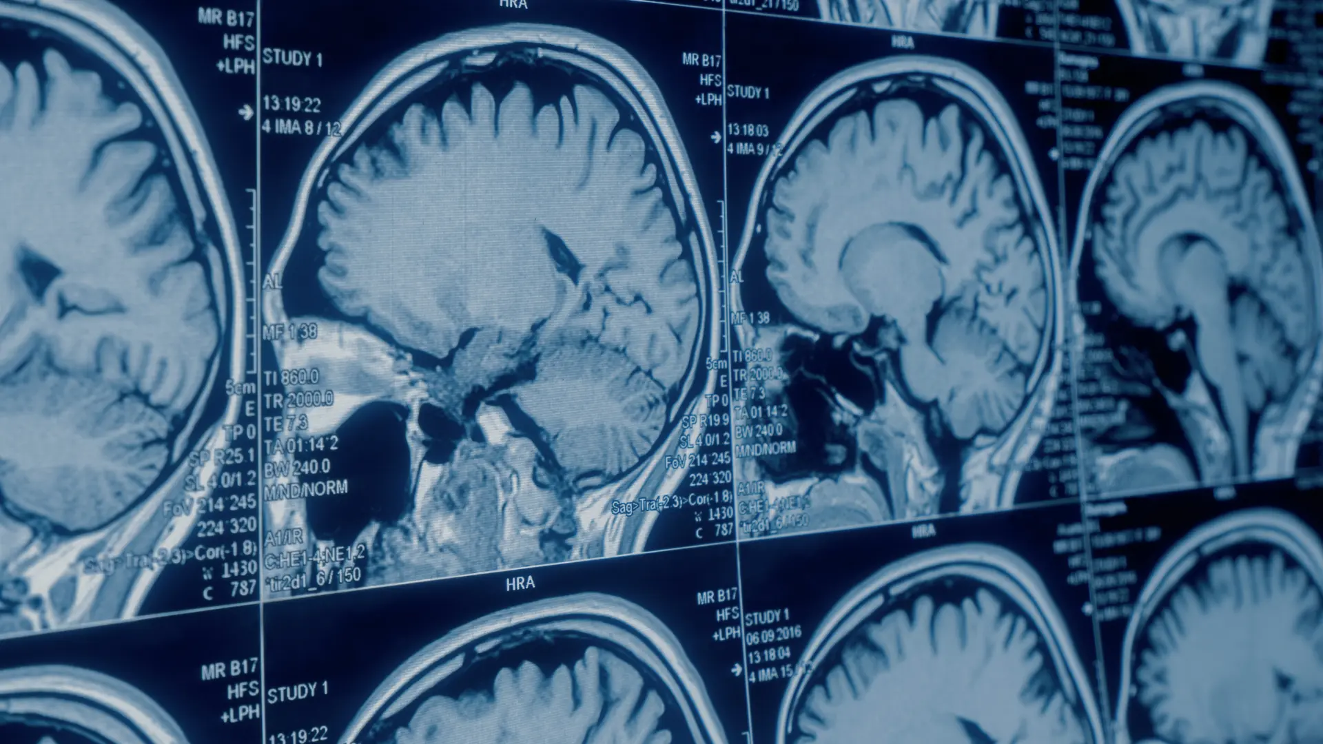 Brain Center Overview